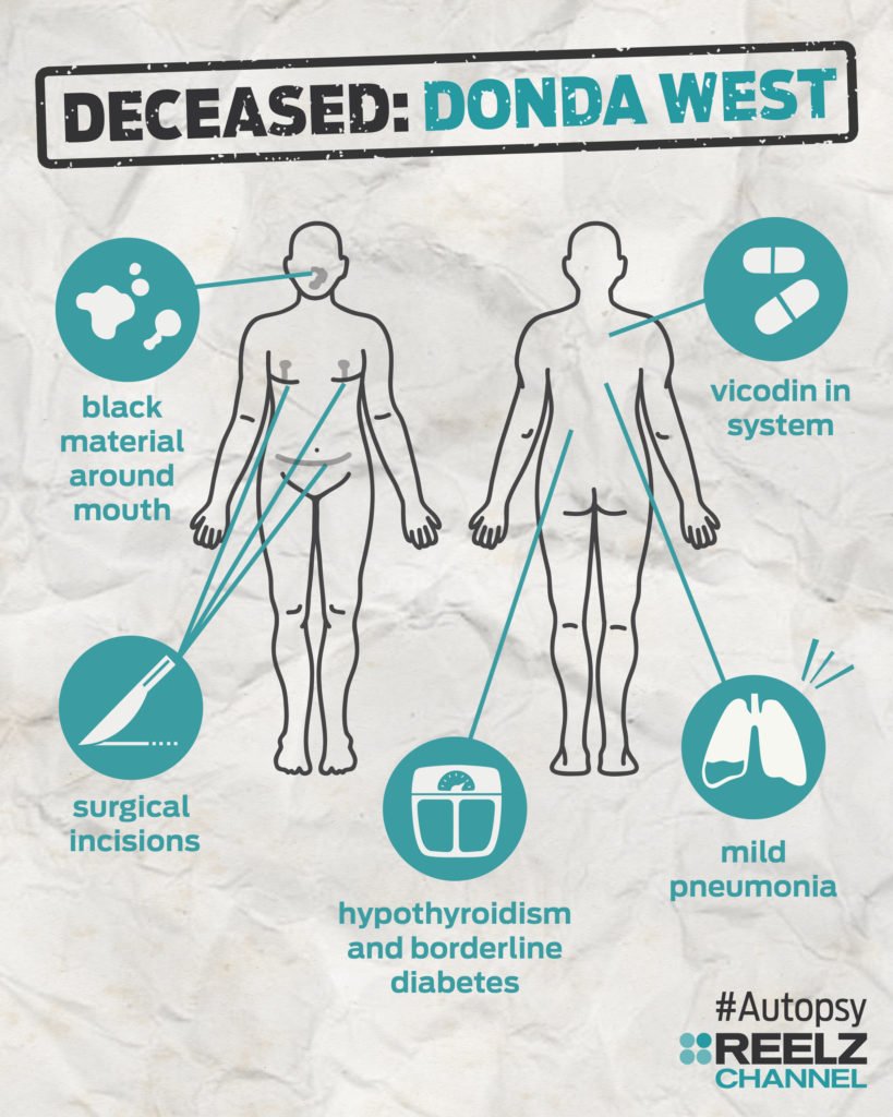 autopsy_infographic_dondawest_blank