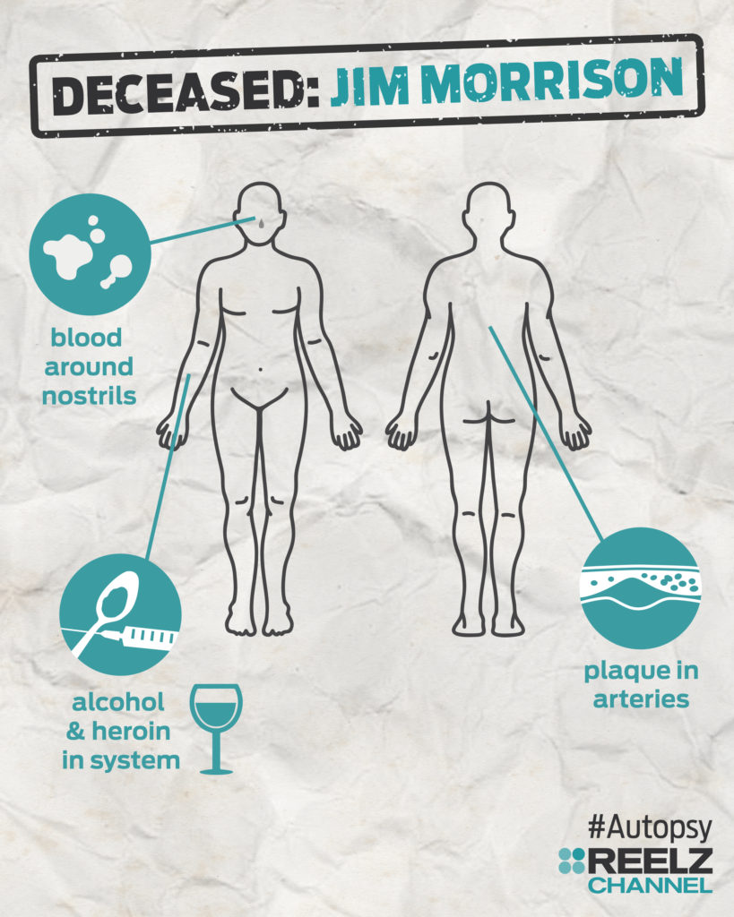 autopsy_infographic_jimmorrison_blank