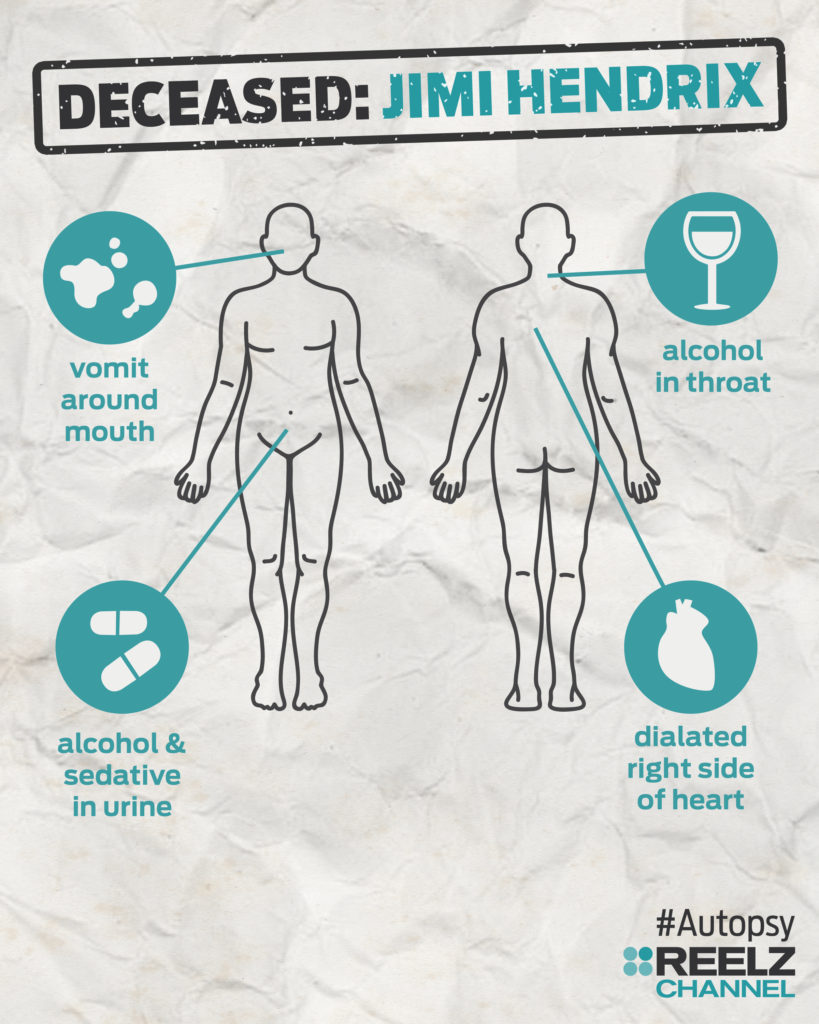autopsy_infographic_jimihendrix_blank