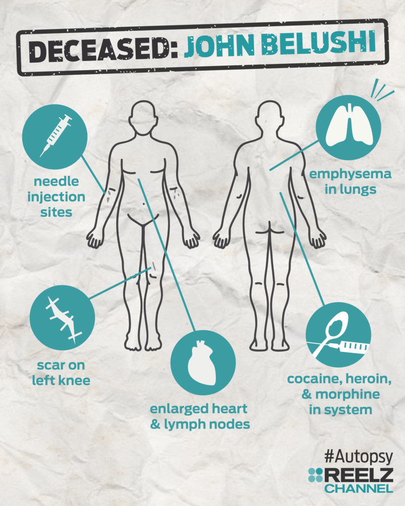 autopsy_infographic_johnbelushi_blank