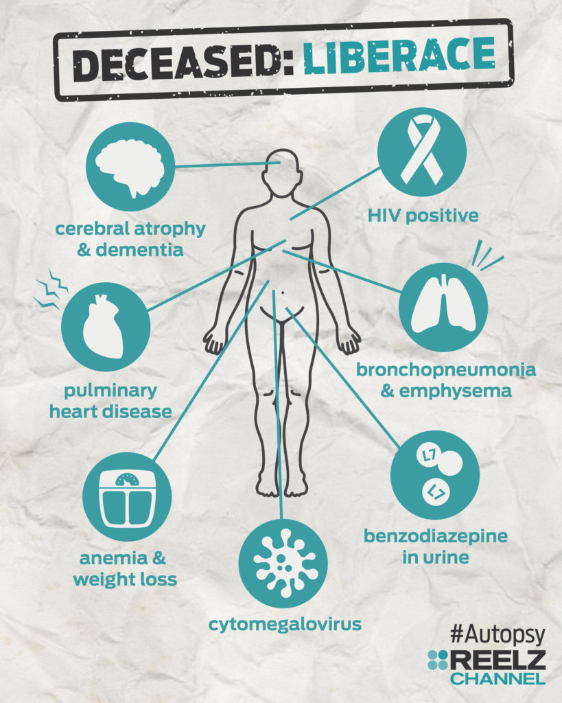 autopsy_infographic_liberace_blank