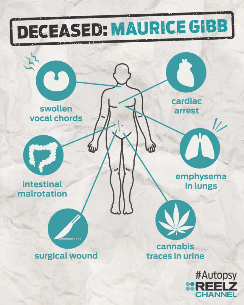autopsy_infographic_mauricegibb_blank