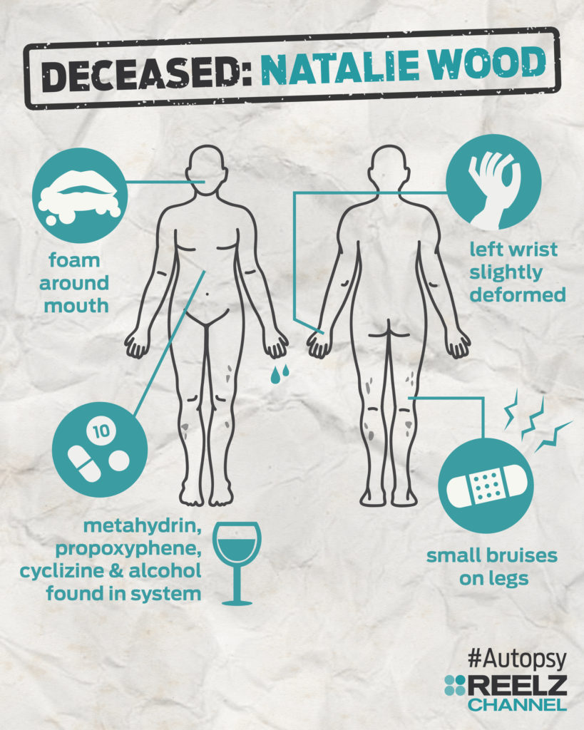autopsy_infographic_nataliewood_blank