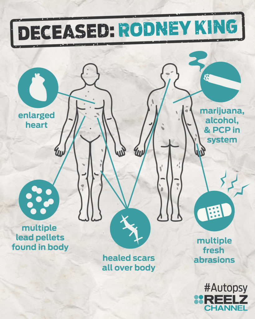 autopsy_infographic_rodneyking_blank